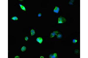 Immunofluorescent analysis of MCF-7 cells using ABIN7161861 at dilution of 1:100 and Alexa Fluor 488-congugated AffiniPure Goat Anti-Rabbit IgG(H+L) (NCOA5 抗体  (AA 112-283))