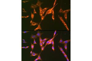 Immunofluorescence analysis of NIH-3T3 cells using Cation-independent Cation-independent M6PR (IGF2R) (IGF2R) Rabbit mAb (ABIN1678848, ABIN3018066, ABIN3018067 and ABIN7101574) at dilution of 1:100 (40x lens).