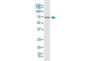 KLF11 monoclonal antibody (M03), clone 10D8. (KLF11 抗体  (AA 404-512))