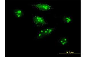 Immunofluorescence of purified MaxPab antibody to MKI67IP on HeLa cell. (NIFK 抗体  (AA 1-293))