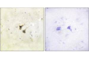 Immunohistochemistry analysis of paraffin-embedded human brain tissue, using PBK/TOPK (Ab-9) Antibody. (PBK 抗体  (AA 1-50))