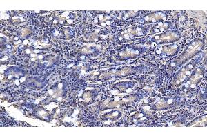Detection of AMH in Human Small intestine Tissue using Monoclonal Antibody to Anti-Mullerian Hormone (AMH)