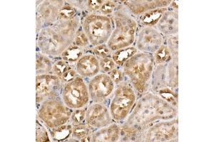 Immunohistochemistry of paraffin-embedded rat kidney using TNK2 Rabbit pAb (ABIN3016189, ABIN3016190, ABIN3016191, ABIN1683072 and ABIN6219613) at dilution of 1:50 (40x lens). (TNK2 抗体  (AA 70-385))