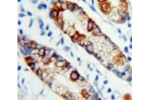 #VALUE! (MPL 抗体  (AA 311-460))