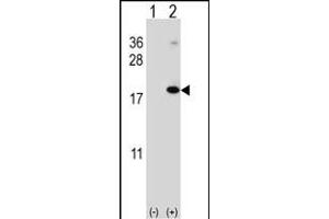 Western blot analysis of RNF5 (arrow) using rabbit polyclonal RNF5 Antibody (N-term) (ABIN652548 and ABIN2842368). (RNF5 抗体  (AA 1-30))