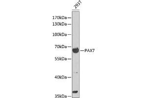 Western blot analysis of extracts of 293T cells, using P antibody (ABIN6132463, ABIN6145262, ABIN6145264 and ABIN6216484) at 1:1000 dilution. (PAX7 抗体  (AA 289-518))