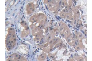 DAB staining on IHC-P; Samples: Human Stomach Tissue (MARS 抗体  (AA 74-198))