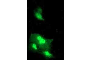 Anti-DTNB mouse monoclonal antibody (ABIN2455578) immunofluorescent staining of COS7 cells transiently transfected by pCMV6-ENTRY DTNB (RC203798). (Dystrobrevin beta 抗体)
