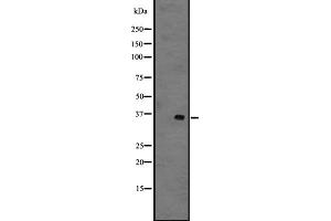 Western blot analysis of GPR141 expression in 721_B whole cell lysate ;,The lane on the left is treated with the antigen-specific peptide.