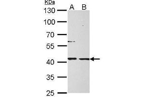 WB Image MPI antibody detects MPI protein by Western blot analysis. (MPI 抗体)