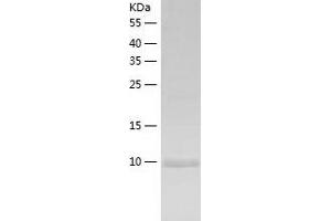 Western Blotting (WB) image for Ubiquitin Related Modifier 1 (Urm1) (AA 1-101) protein (His tag) (ABIN7288602) (Urm1 Protein (AA 1-101) (His tag))