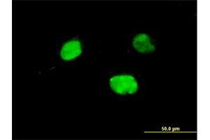 Immunofluorescence of monoclonal antibody to IRX5 on HeLa cell. (IRX5 抗体  (AA 204-264))