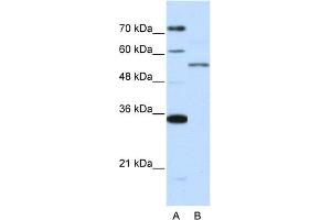 WB Suggested Anti-ZNF707 Antibody Titration:  0. (ZNF707 抗体  (N-Term))