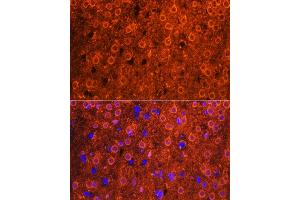 Immunofluorescence analysis of mouse brain using CDK6 antibody (ABIN7266595) at dilution of 1:100. (CDK6 抗体  (AA 1-326))