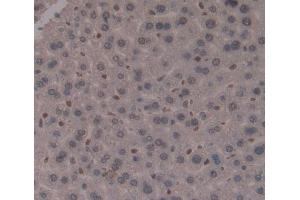Used in DAB staining on fromalin fixed paraffin- embedded Kidney tissue (MTF1 抗体  (AA 2-139))