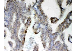 IHC analysis of PAH using anti-PAH antibody . (Phenylalanine Hydroxylase 抗体  (AA 71-208))