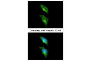 ICC/IF Image Immunofluorescence analysis of methanol-fixed HeLa, using GPR82, antibody at 1:200 dilution. (GPR82 抗体)