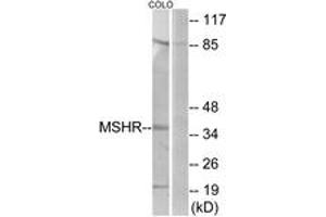 Western blot analysis of extracts from COLO205 cells, using MSHR Antibody. (MC1 Receptor 抗体  (AA 268-317))