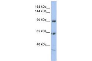 Image no. 1 for anti-Two Pore Segment Channel 1 (TPCN1) (AA 71-120) antibody (ABIN6742558) (TPCN1 抗体  (AA 71-120))