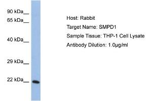 Host: Rabbit Target Name: SMPD1 Sample Tissue: Human THP-1 Whole Cell Antibody Dilution: 1ug/ml (SMPD1 抗体  (Middle Region))