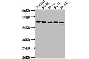 Western Blot Positive WB detected in: Jurkat whole cell lysate, K562 whole cell lysate, Hela whole cell lysate, Raji whole cell lysate, HepG2 whole cell lysate All lanes: FUBP1 antibody at 1:2000 Secondary Goat polyclonal to rabbit IgG at 1/50000 dilution Predicted band size: 68, 69 kDa Observed band size: 69 kDa (Recombinant FUBP1 抗体)