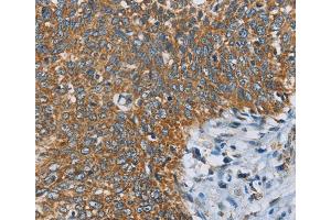 Immunohistochemistry (IHC) image for anti-Ankyrin Repeat and KH Domain Containing 1 (ANKHD1) antibody (ABIN2422950) (ANKHD1 抗体)
