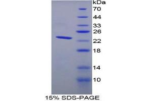 SDS-PAGE analysis of Rat TNNI2 Protein. (TNNI2 蛋白)