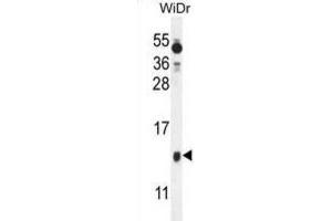 Western Blotting (WB) image for anti-Brain Expressed, X-Linked 1 (BEX1) antibody (ABIN2995790) (BEX1 抗体)