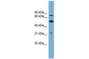 Image no. 1 for anti-Tousled-Like Kinase 2 (TLK2) (AA 35-84) antibody (ABIN6745638) (TLK2 抗体  (AA 35-84))