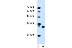 Carbonyl Reductase 1 antibody used at 1. (CBR1 抗体  (C-Term))