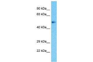 Host:  Rabbit  Target Name:  ZBTB25  Sample Type:  Uterus Tumor lysates  Antibody Dilution:  1. (ZBTB25 抗体  (Middle Region))