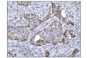 IHC analysis of DLGAP1 using anti-DLGAP1 antibody (ABIN7600257). (DLGAP1 抗体  (AA 17-319))
