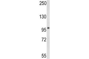 Western Blotting (WB) image for anti-DEAD (Asp-Glu-Ala-Asp) Box Polypeptide 58 (DDX58) (AA 585-614) antibody (ABIN3030700)