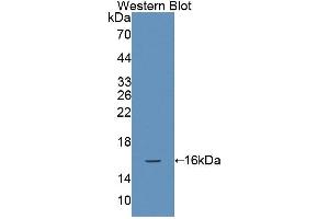 Western blot analysis of the recombinant protein. (NCR3 抗体  (AA 22-135))