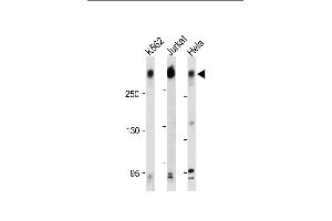 All lanes : Anti-PCM-1 Antibody (C-term) at 1:500-2000 dilution Lane 1: K562 whole cell lysate Lane 2: Jurkat whole cell lysate Lane 3: Hela whole cell lysate Lysates/proteins at 20 μg per lane. (PCM1 抗体  (C-Term))