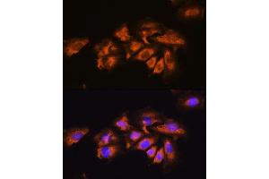 Immunofluorescence analysis of C6 cells using A antibody (ABIN1678588, ABIN3015506, ABIN3015508 and ABIN6218562) at dilution of 1:100.