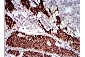 Immunohistochemistry (IHC) image for anti-Calponin 1 (CNN1) (AA 16-165) antibody (ABIN5542502)