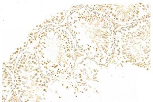 ABIN6265200 and ABIN6269069 at 1/100 staining Rat testis tissue by IHC-P. (SNAIL 抗体  (C-Term))
