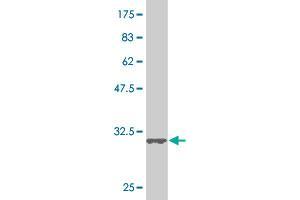 Western Blot detection against Immunogen (34. (SMAD5 抗体  (AA 105-182))
