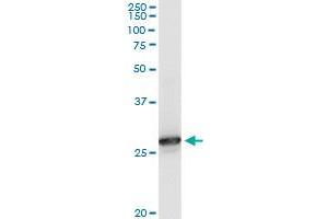 PRDX6 monoclonal antibody (M01), clone 3A10-2A11. (Peroxiredoxin 6 抗体  (AA 1-224))