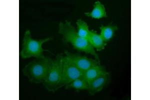 IF analysis of PAK2 using anti-PAK2 antibody (ABIN7599219). (PAK2 抗体  (AA 1-288))