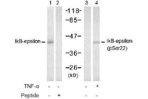 Image no. 2 for anti-Nuclear Factor of kappa Light Polypeptide Gene Enhancer in B-Cells Inhibitor, epsilon (NFKBIE) (pSer22) antibody (ABIN196948)