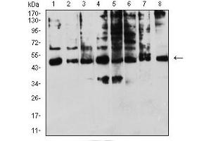 Western Blotting (WB) image for anti-Killer Cell Immunoglobulin-Like Receptor, three Domains, Long Cytoplasmic Tail, 1 (KIR3DL1) (AA 22-340) antibody (ABIN5611328)