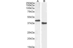 Western Blotting (WB) image for anti-Paired Box 5 (PAX5) (N-Term) antibody (ABIN184804)