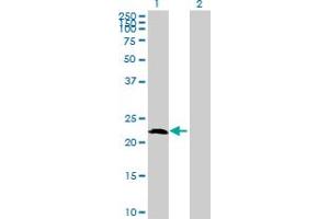 Western Blot analysis of AMELX expression in transfected 293T cell line by AMELX MaxPab polyclonal antibody. (AMELX 抗体  (AA 1-191))