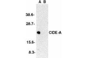 Western blot analysis of CIDE-A in human brain tissue lysate in the absence (A) or presence (B) of peptide with AP30229PU-N CIDE-A antibody at 1/2000 dilution. (CIDEA 抗体  (C-Term))