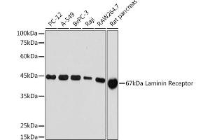 Western blot analysis of extracts of various cell lines, using 67 kDa Laminin Receptor Rabbit mAb (ABIN7270042) at 1:1000 dilution. (RPSA/Laminin Receptor 抗体)