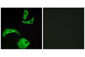 Immunofluorescence analysis of HeLa cells, using GPR18 antibody. (GPR18 抗体  (Internal Region))