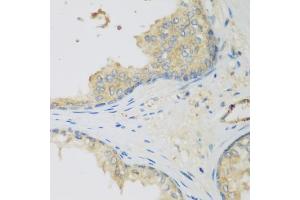 Immunohistochemistry of paraffin-embedded human prostate using LLGL2 antibody (ABIN5975836) at dilution of 1/200 (40x lens). (LLGL2 抗体)