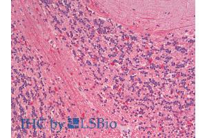 ABIN1590014 (5µg/ml) staining of paraffin embedded Human Cerebellum. (ZNRF1 抗体  (Internal Region))